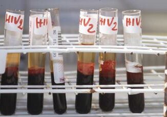 Aids, un'iniezione due volte all'anno può prevenire l'Hiv 5 Aids uniniezione due volte allanno puo prevenire lHiv