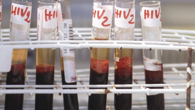 Aids, l’accusa di Bassetti: “Torna a far paura per colpa di Trump”