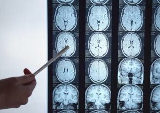 Un'ameba nel cervello dopo lavaggi nasali sbagliati, 10 casi negli Usa 4 Unameba nel cervello dopo lavaggi nasali sbagliati 10 casi negli Usa