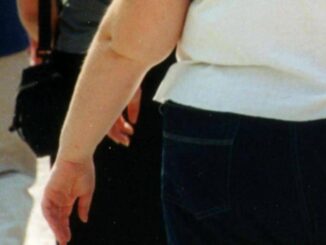 Salute allerta endocrinologi obesita triplicata in donne e raddoppiata in uomini