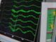 Terremoto in Francia scossa 3.6 avvertita anche a Imperia