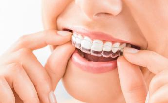 Dr. Claudio Mocci (Dent.AL.): “Nuovi traguardi per ortodonzia e allineatori: soluzioni moderne per un sorriso allineato”
