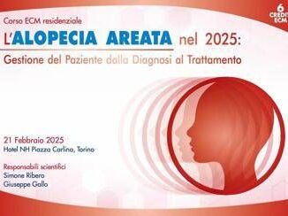 Conoscere lAlopecia Areata a Torino se ne parla in un corso