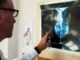 Cancro al seno crioablazione nuova frontiera di cura