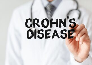 Farmaci Ue approva ampliamento indicazione mirikizumab in malattia di Crohn