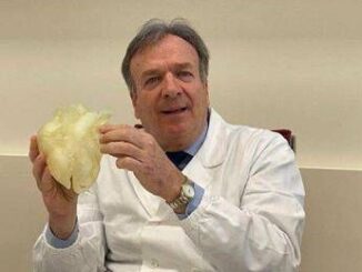 Medicina prima mondiale a Padova esiti infezione aspirati da aorta a cuore battente