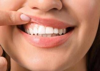 Salute in 70 persone con autismo problemi a denti e gengive parodontologi in campo