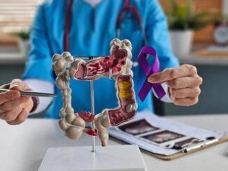 Tumori colorettale metastatico refrattario ok Aifa a rimborsabilita nuova terapia