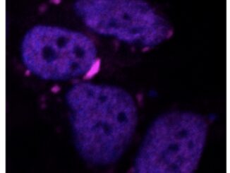 Ia algoritmo Iit va a caccia di proteine dannose per il cervello