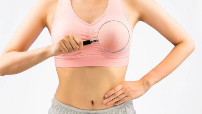 Cancro seno, esperti ‘in Campania biopsia liquida utile per 720 donne l’anno’