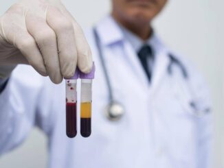 Farmaceutica Gardini GenomeUp Ai per programmare terapie con plasmaderivati