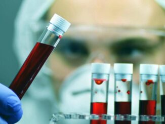Giornata Ail con ricerca e cura a fianco dei pazienti con neoplasie del sangue