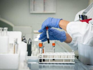 Mielofibrosi ematologo Con uso precoce momelotinib maggiore sopravvivenza
