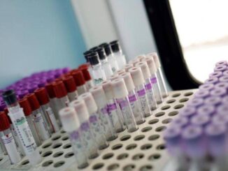 Mielofibrosi speranze da nuovo farmaco che limita lanemia in 2 pazienti su 3