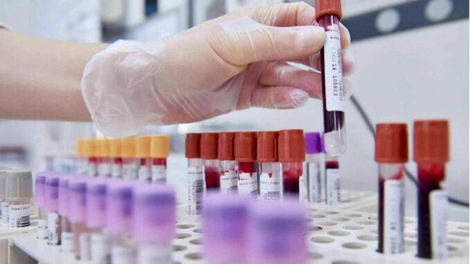 Sibioc, su ipotesi Regione Lazio: “No esternalizzazione medicina di laboratorio”